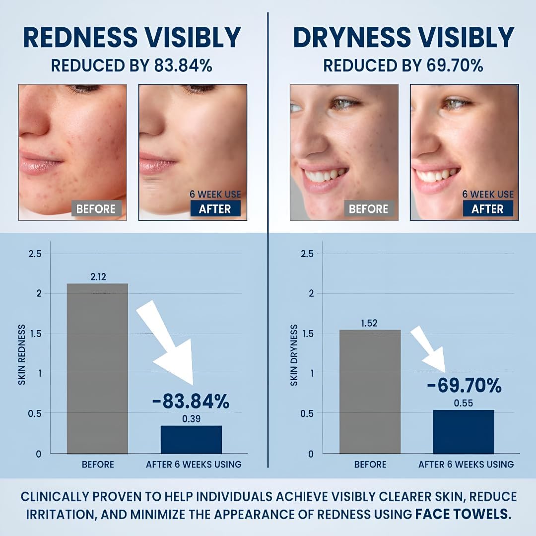 BuzyBe 50 Pcs Disposable Face Towels | 100% Biodegradable Dry Facial Wipes | Ultra Soft & Absorbent Cleansing Towels for Face & Hands | Makeup Removal & Travel Towels with Facial Sponge